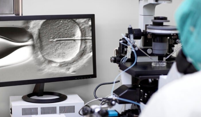 Ein mikroskopisches Bild der intrazytoplasmatischen Spermieninjektion (ICSI), das auf einem Computerbildschirm angezeigt wird, wobei die Nadel gerade dabei ist, Spermien in die Eizelle zu injizieren, während im Hintergrund Laborausrüstung und ein Mikroskop sichtbar sind.
