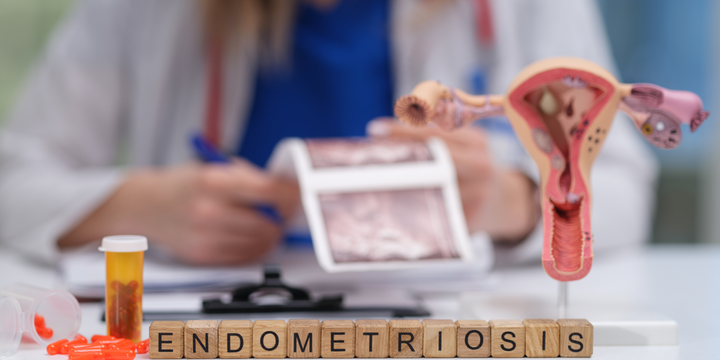 Darstellung von Endometriose und Adenomyose mit Fokus auf versteckte Herausforderungen für Frauengesundheit, Fruchtbarkeit und gynäkologische Erkrankungen