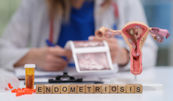 Darstellung von Endometriose und Adenomyose mit Fokus auf versteckte Herausforderungen für Frauengesundheit, Fruchtbarkeit und gynäkologische Erkrankungen